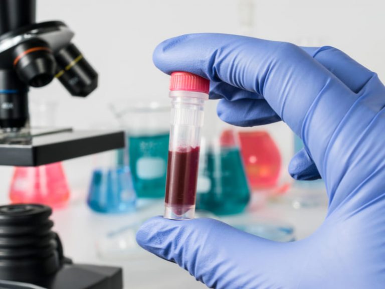 Coronavirus en Tierra del Fuego: se confirmaron 17 casos positivos en Río Grande sobre 73 muestras analizadas