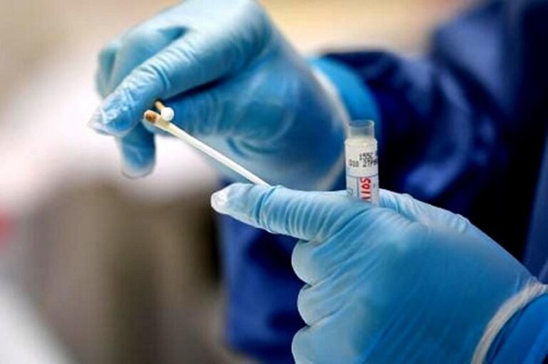 Desde el 1 de diciembre se dejará sin efecto el análisis de PCR como requisito obligatorio para el ingreso a la provincia
